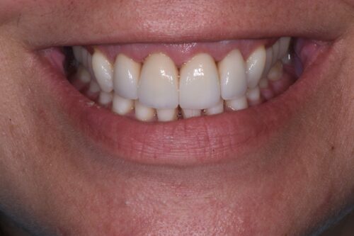 after dental services from Monokian Dentistry