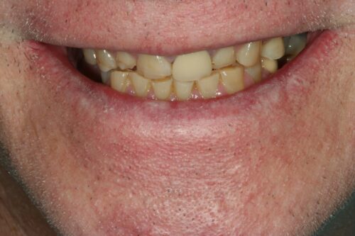 before dental services from Monokian Dentistry