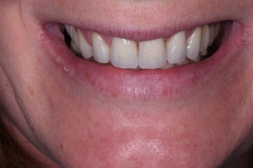 after dental services from Monokian Dentistry