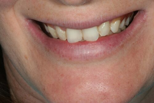 before dental services from Monokian Dentistry