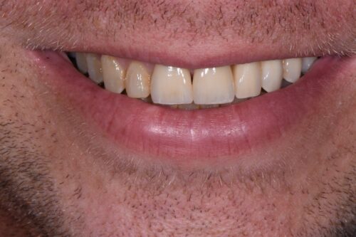 after dental services from Monokian Dentistry