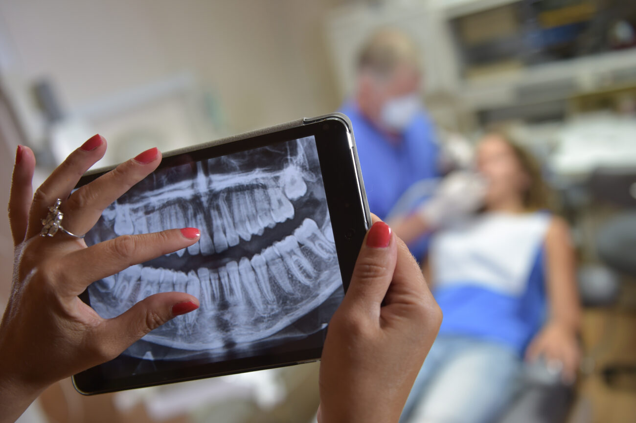 Dentist reviewing a dental X-ray on a tablet before a tooth extraction
