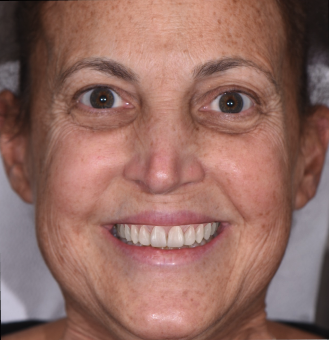 Her Future Smile